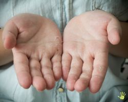 "Detailfoto van een hand met zichtbare schilfering en droge huid, vooral rond de knokkels en vingertoppen. De huid toont tekenen van uitdroging, ruwheid en verminderde elasticiteit, vaak veroorzaakt door kou, lage luchtvochtigheid of frequent contact met water en zeep. Deze afbeelding is geschikt als visuele ondersteuning bij content over huidverzorging, droge handen, eczeem of producten zoals Ambachtscrème en huidolie met vitamine E.